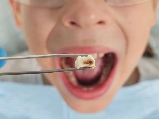 Best Tooth Pain Emergency Relief  in Harrisburg, SD